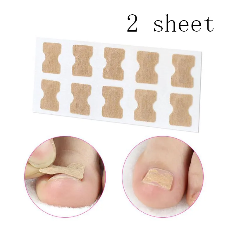 Glue-free orthopaedic nail fixation device - Beige