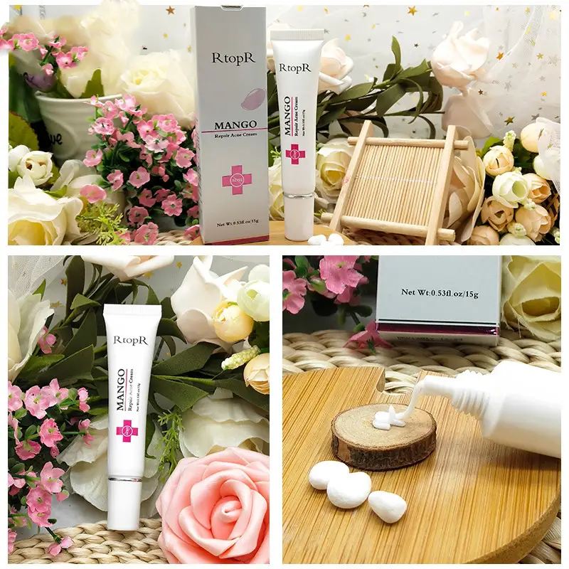 RtopR mango acne cream