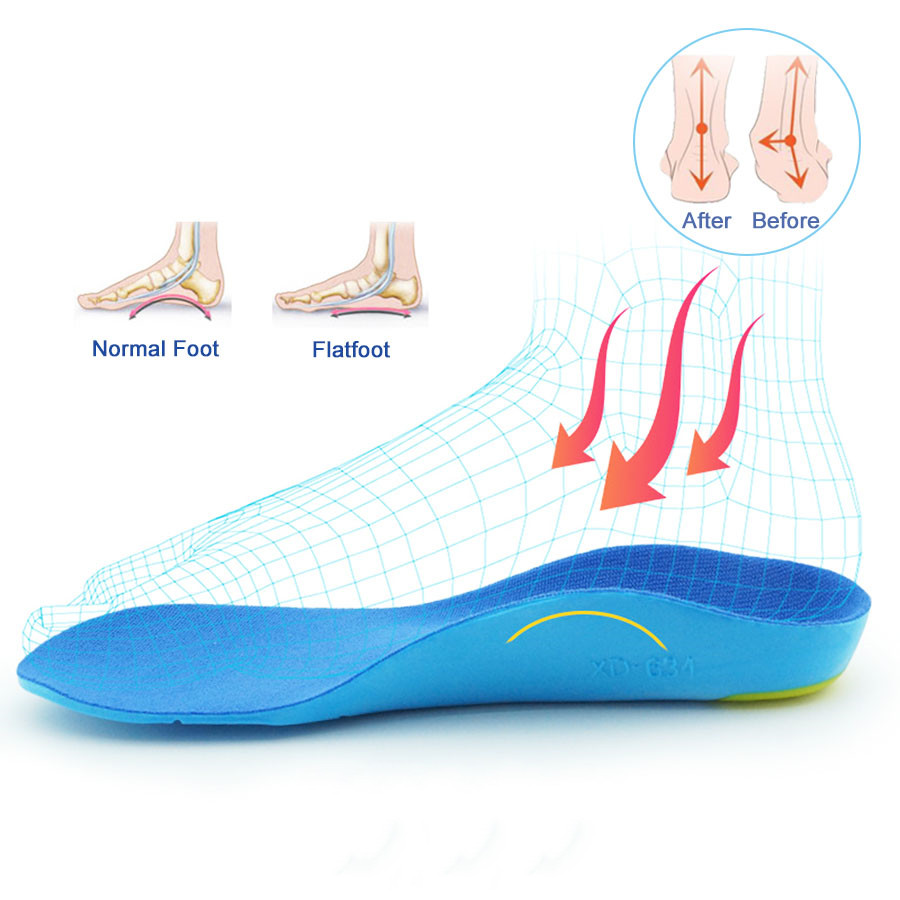 Children's Insoles O/X Leg Foot Valgus Arch Support Orthosis Flat Foot Correction Insole Foot Care — view 2
