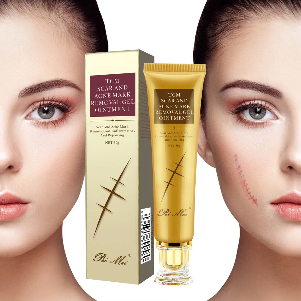 Light Scar Cream Fine Grain Desalination Skin Care Products