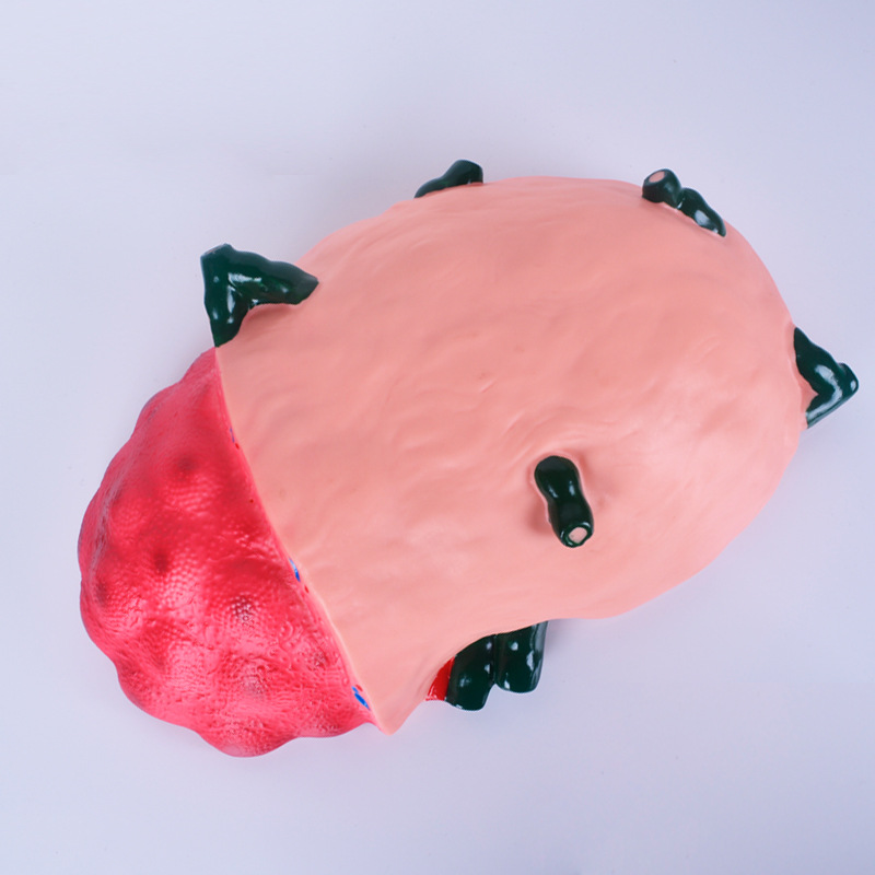 Lymph Node Enlargement Model Biology Teaching Instrument