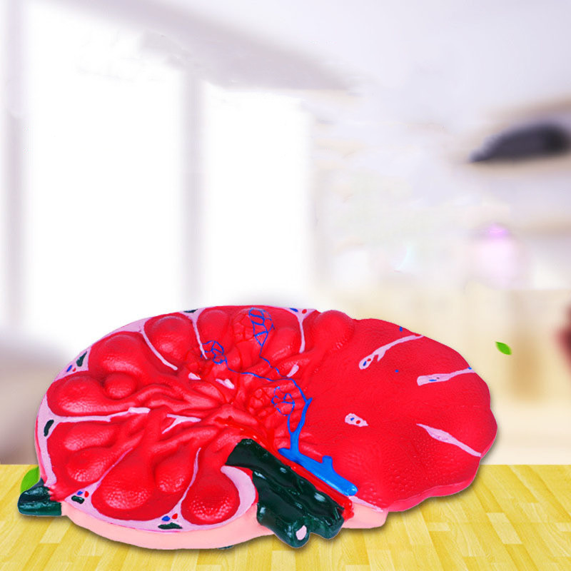 Lymph Node Enlargement Model Biology Teaching Instrument