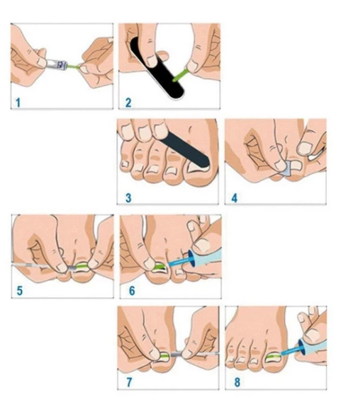 Nail patch — foto 2