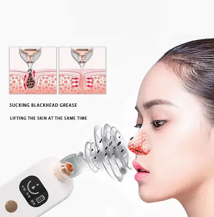 Blackhead suction artifact