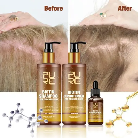 PURC Hair Care Ginger Biotin Three-piece Shampoo Conditioner Repair