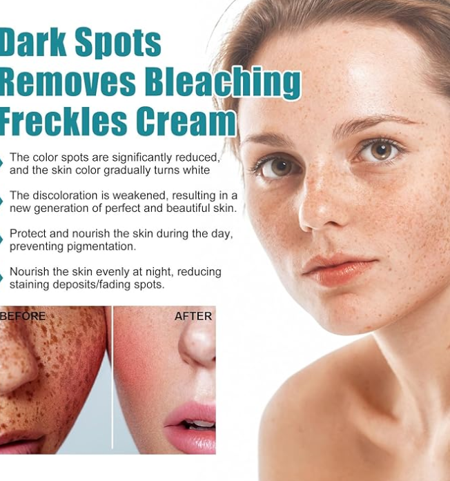 Eelhoe - Dark Spots Removes Cream 4