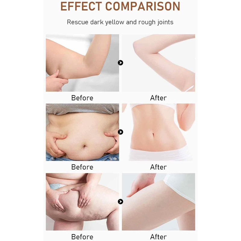 Slimming Oil,30ml Belly Drainage Slimming Oil With Natural Plant Extracts - Moisturizing Slimming Essential Oil Fast Burner For Belly, Waist, Arms, Legs, Butt