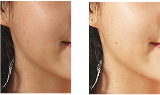 Мини-вращающаяся щетка для очищения пор для лица