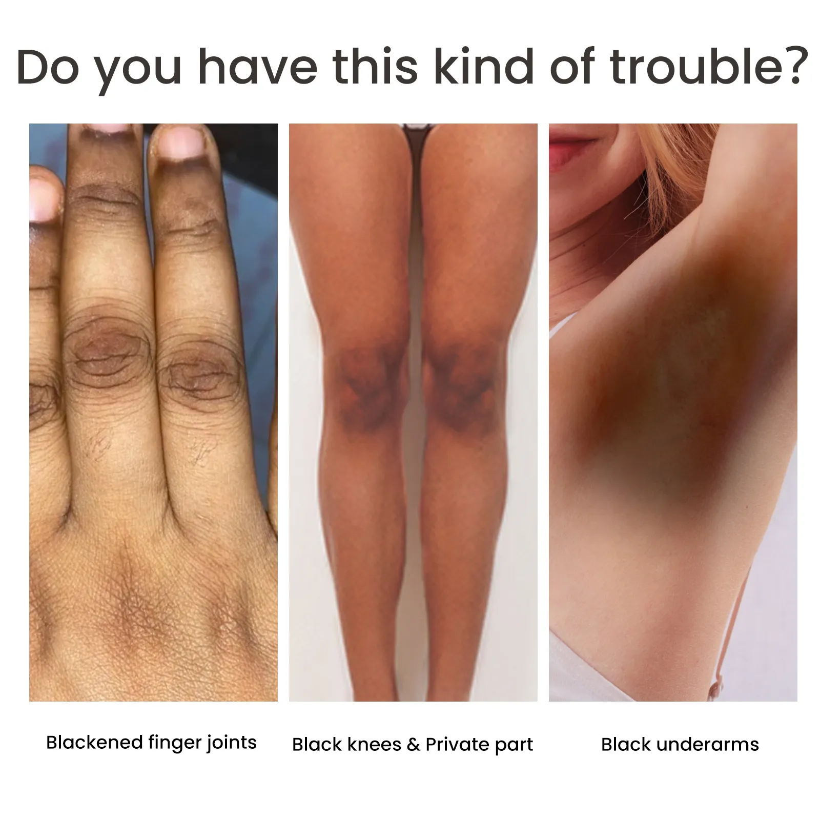 Women's Skin Pigmentation Care – image 3