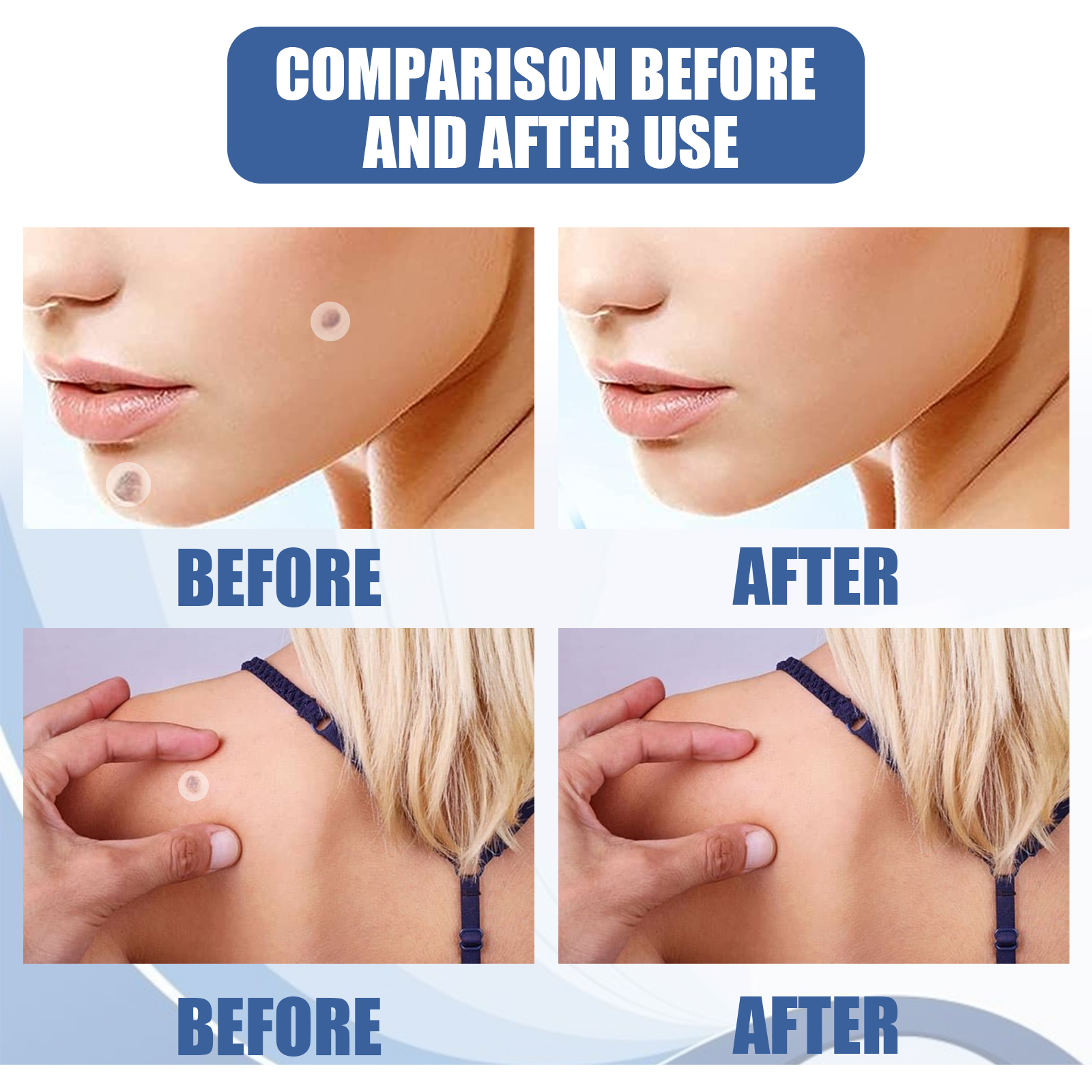 Skin Smoothing Patches   144PCS — foto 3
