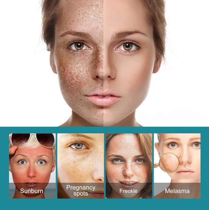 Eelhoe - Dark Spots Removes Cream 3