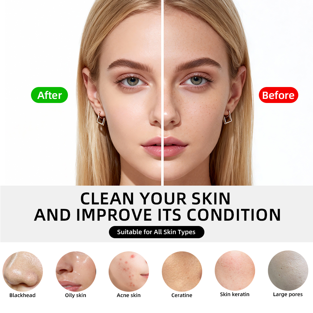 Portable Compact Hot Cold Face Cleaner Heat Clean Cold Converge Pore Management Tool For Home Travel 7