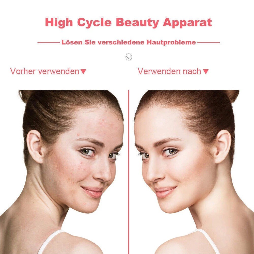 High Frequency Electrotherapy Skin Therapy Wand Machine