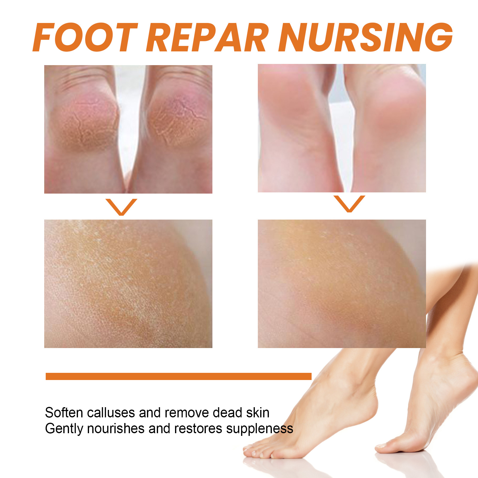 Title 4, Foot Exfoliating Spray Mild Callose Remove Dead...