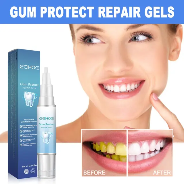 Yierhao Tooth Repair Gel, Repair Gums, Clean Teeth Stains, Tartar, Oral Care 4Pcs - Shop at LoveMi