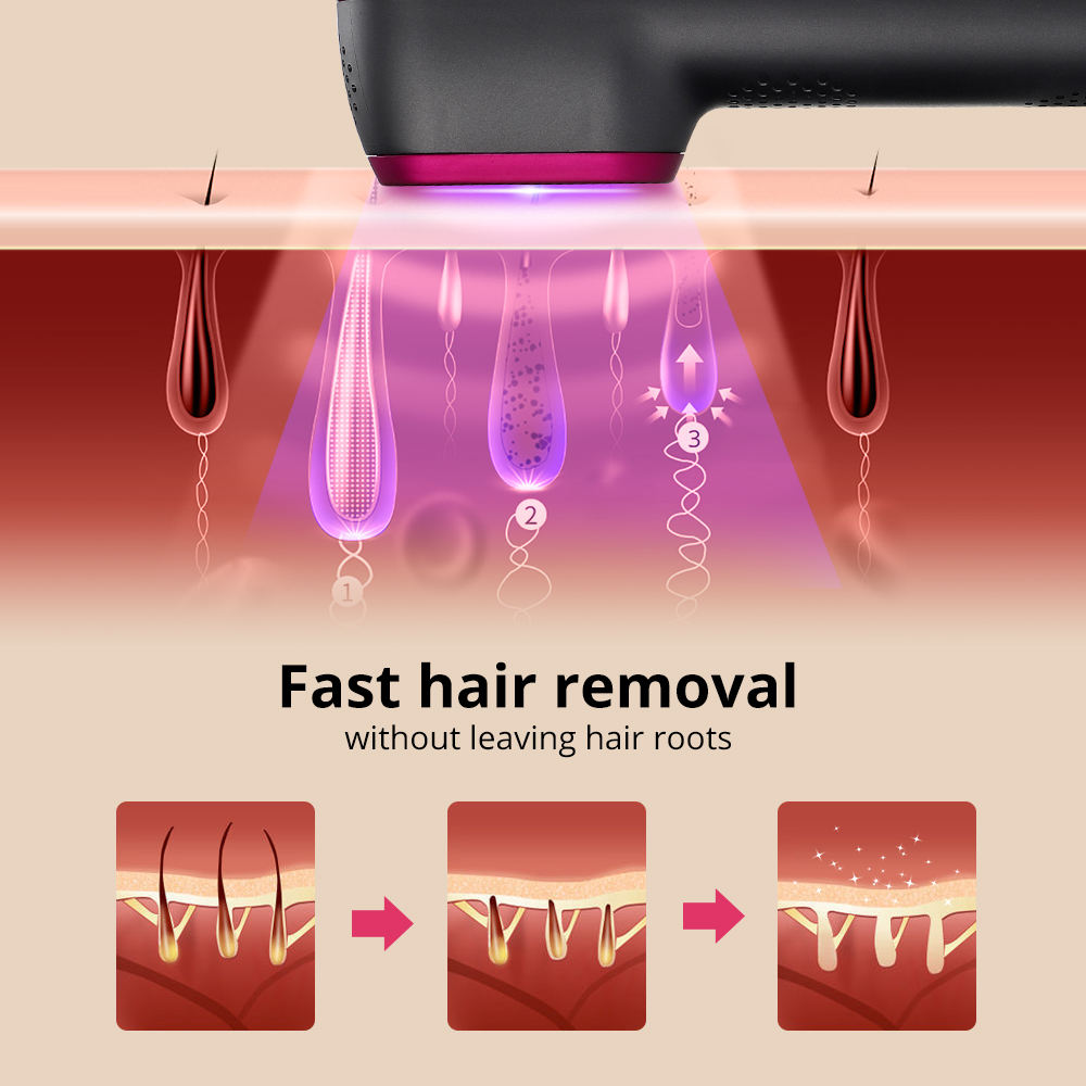 1PCS Laser Hair Removal For Women And Man 100,000 Flashes IPL Painless Laser Hair Removal — foto 2