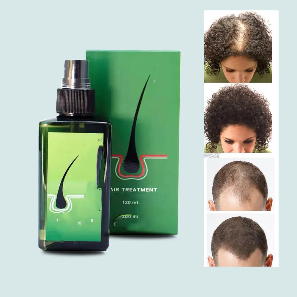 Removing Dandruff