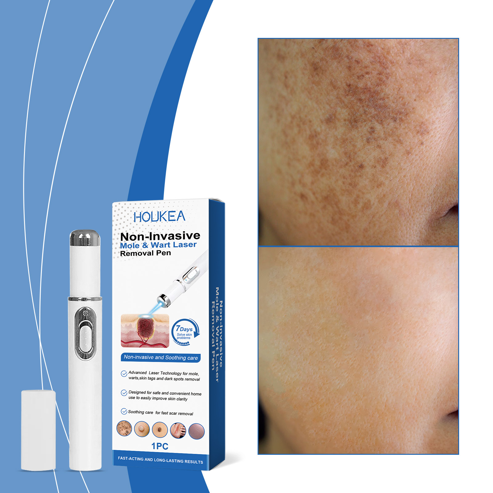 Skin Care Laser Pen 1pc
