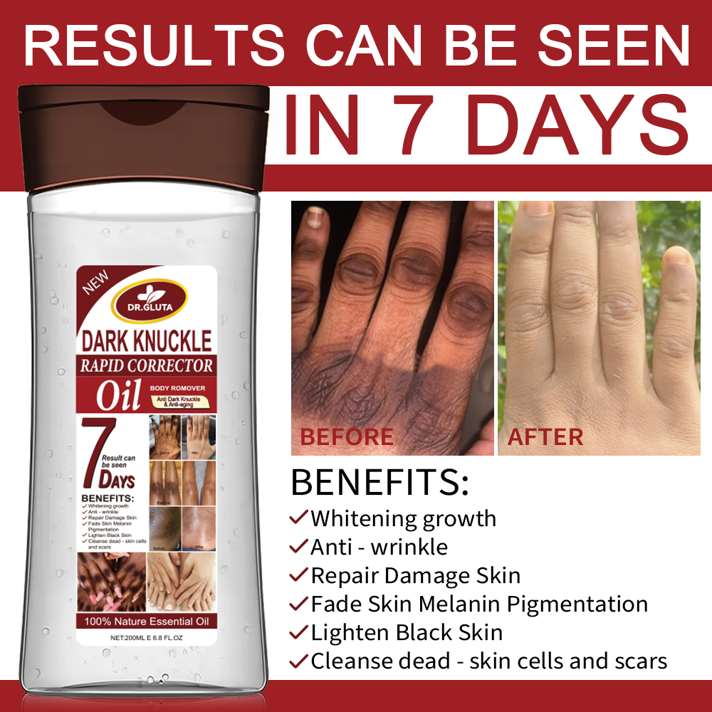 Dark Knuckle Body Oil Anti Dark Knuckle & Anti Aging Whitening Oil Skin Care 200ml