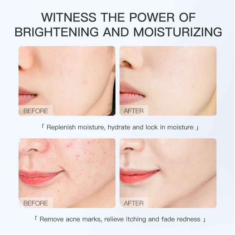 Gongpei Brightening Extract Sheet Mask 25ml Per Sheet — foto 7