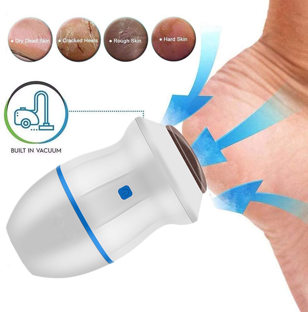 callus remover