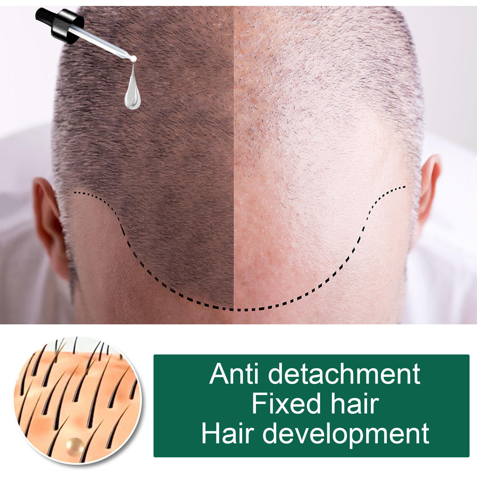 New Hairline Anti-drop - Image 9