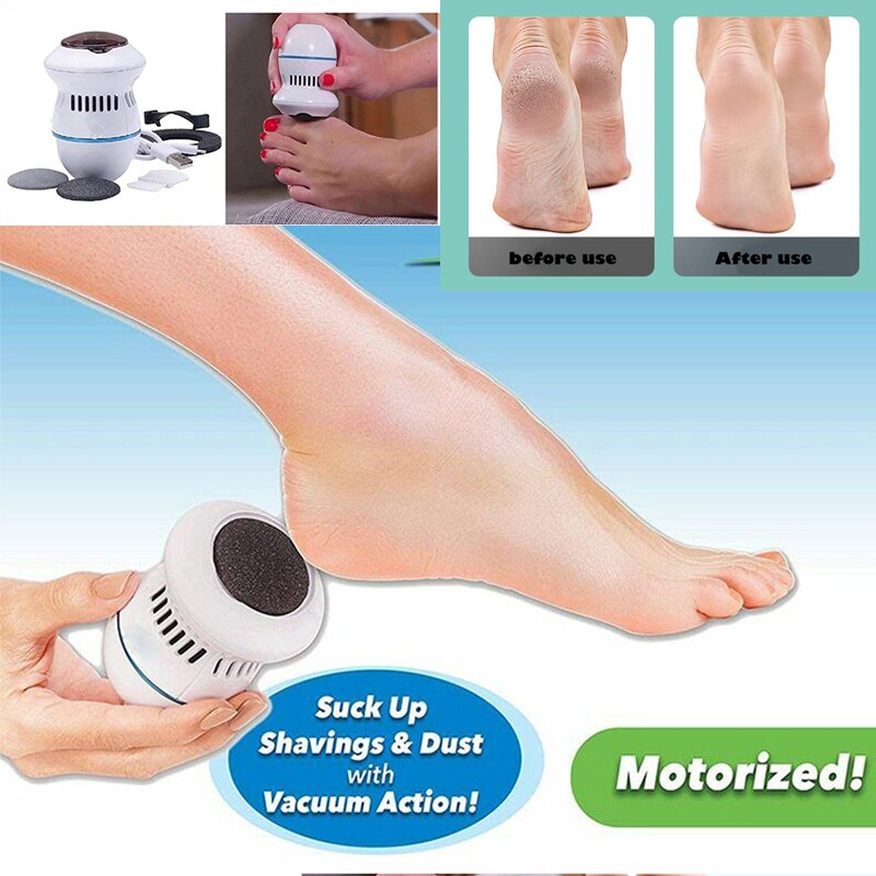 callus remover for feet