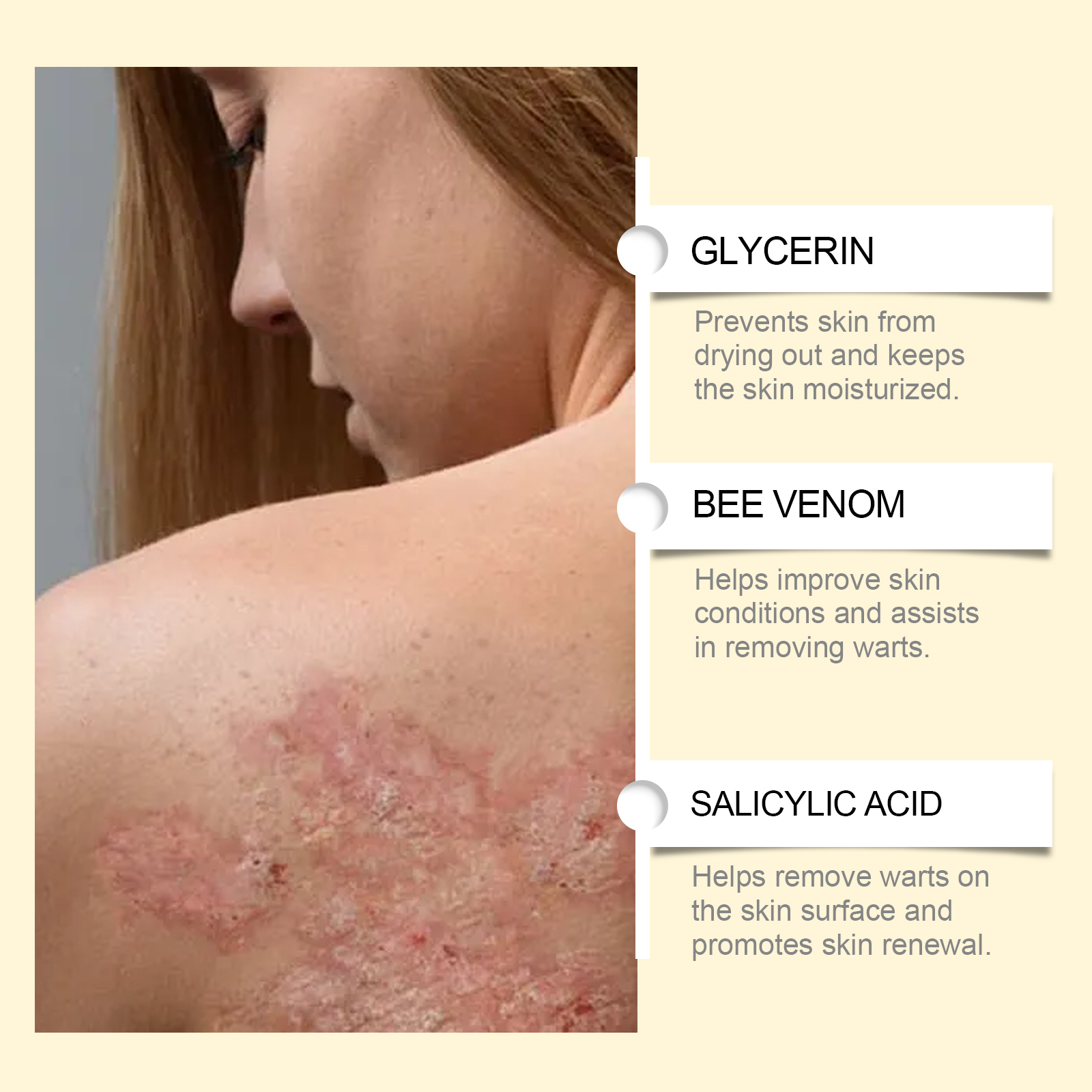 Bee V Enom Skin Care Cream 60g 1 Box — foto 7