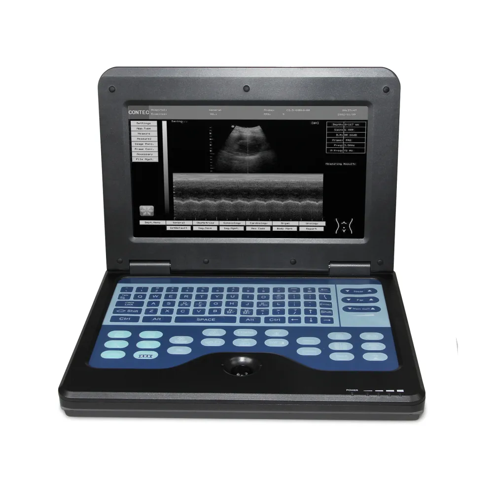 Portable Ultrasound Scanner Laptop Digital Diagnostic Machine 3.5 Convex