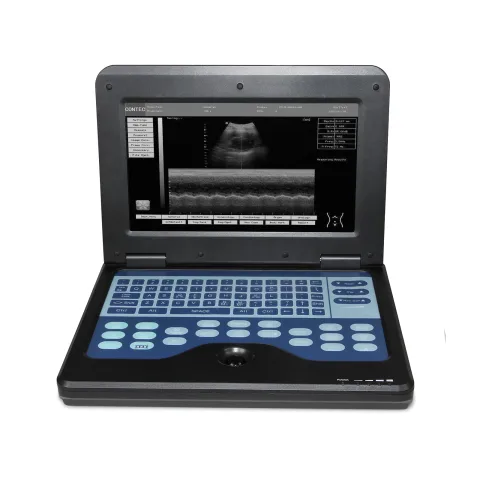 Portable Ultrasound Scanner Laptop Digital Diagnostic Machine 3.5 Convex