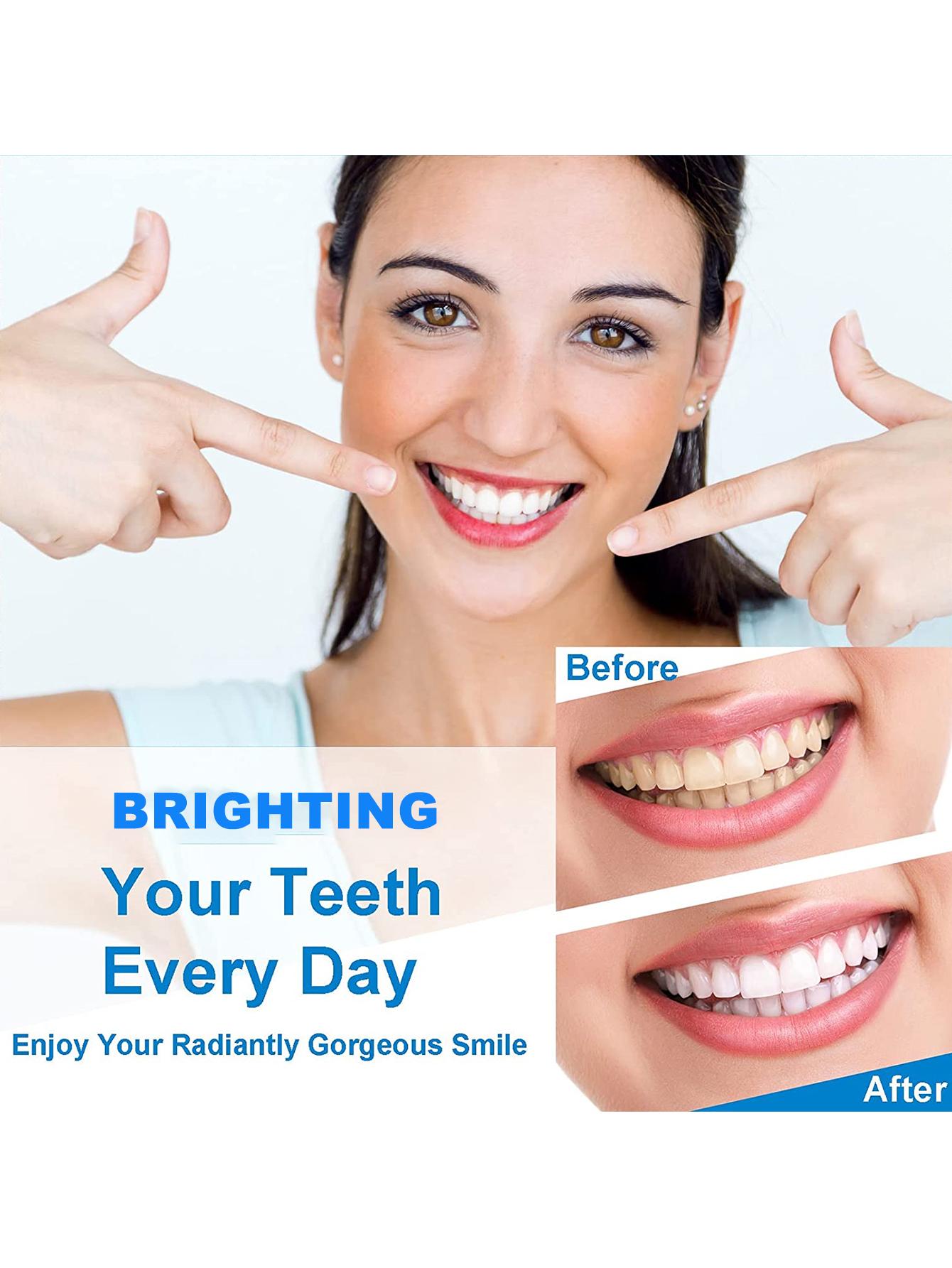 Gentle Teeth Whitening Strips - Image 1 of 5
