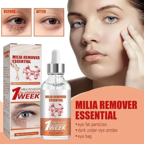Smooth Milia Remover Serum 30Ml - Shop at LoveMi