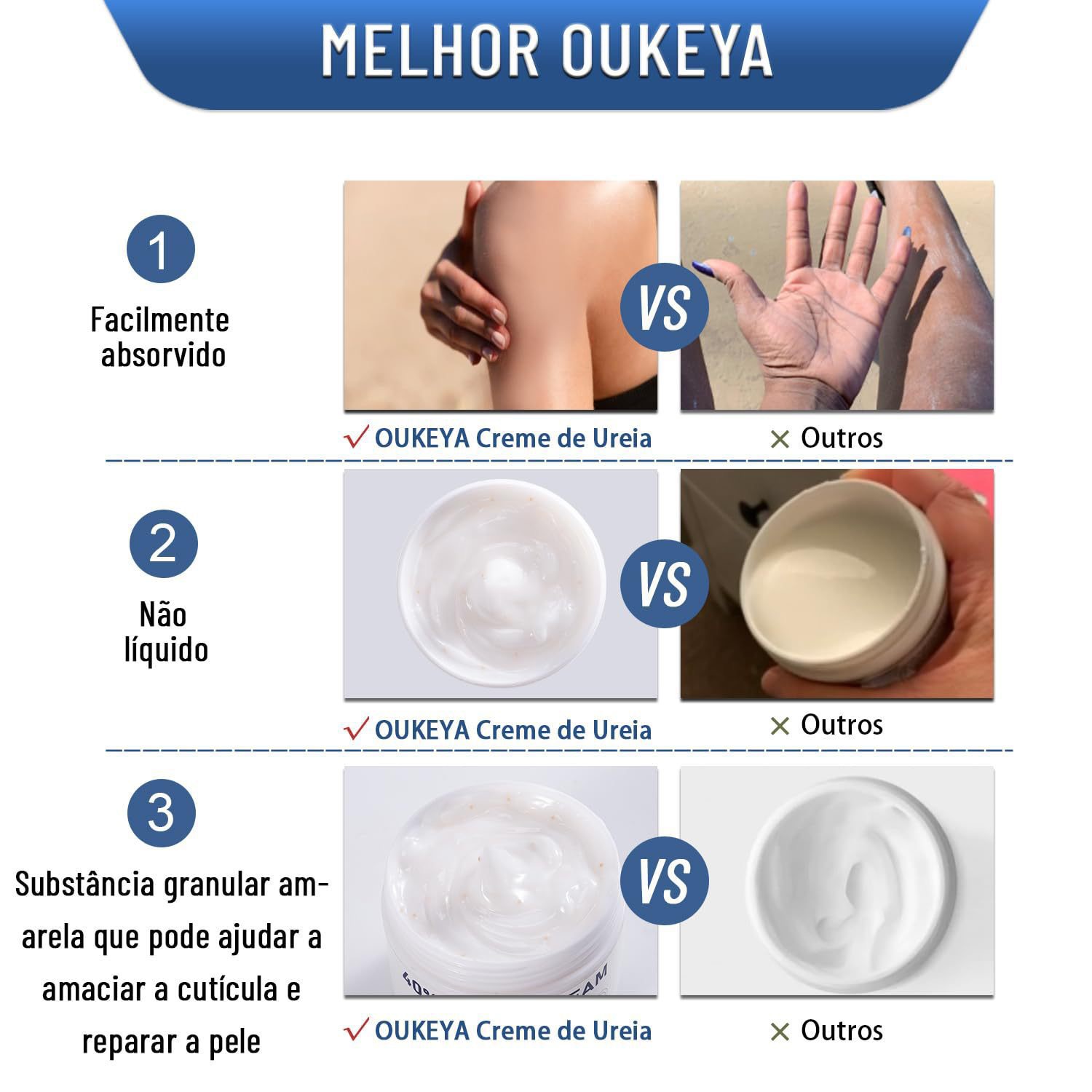 Urea Cream Moisturizing Hand And Foot Cream For Dryness Prevention — foto 5