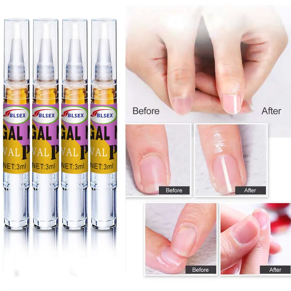 Nail Treatment Fluid Fungus