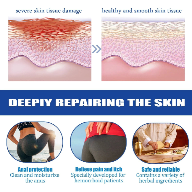 South Moon - Strength Hemorrhoids Capsules 4