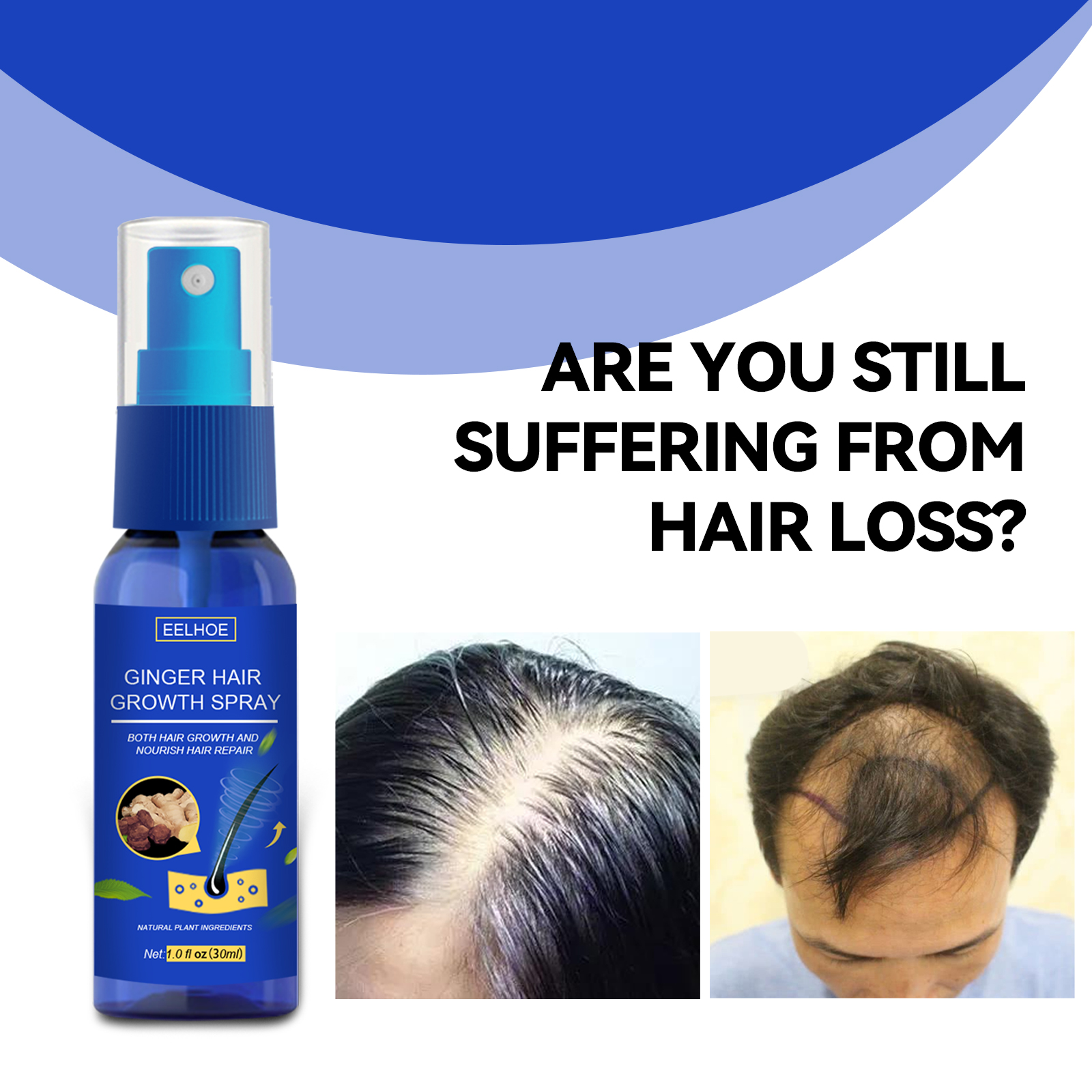 EELHOE Ginger Hair Thickening Spray, Scalp Massage Moisturizing Hair Care Nutrition Spray