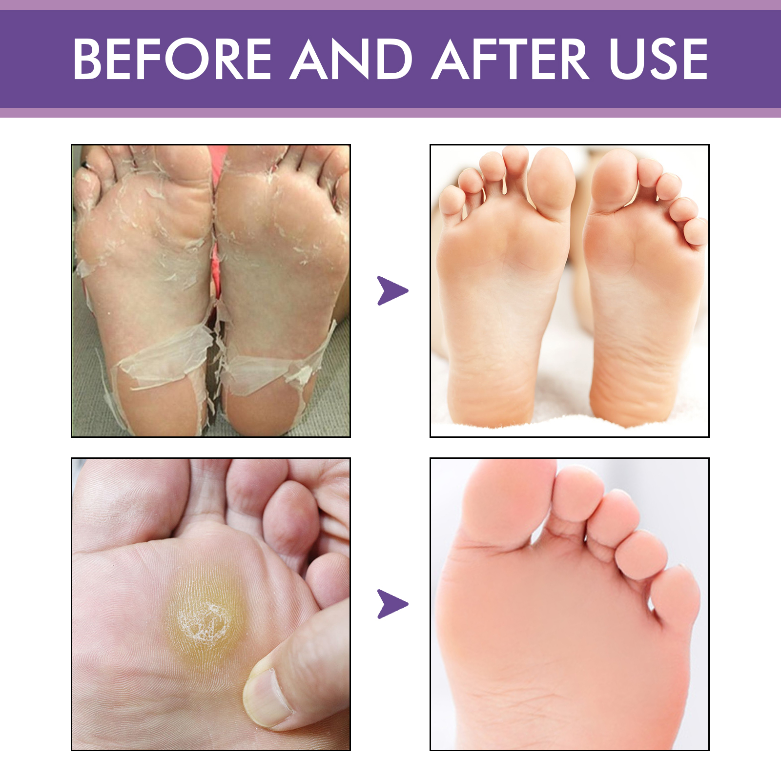 West&Month Lavender Peel Mask, Moisturizing Foot Cleansing Keratin Anti-cracking And Dead Skin Care Foot Mask