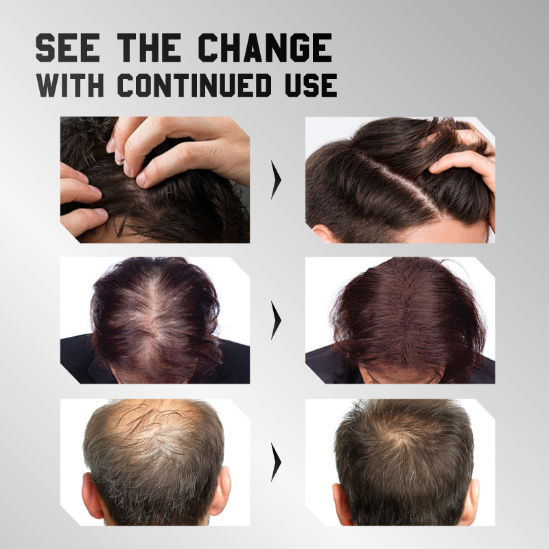 GreenVibes Anti-Breakage Hair Nourishing Essence, Repairs Dry And Frizzy Hair For Silky Smooth Tresses — foto 14