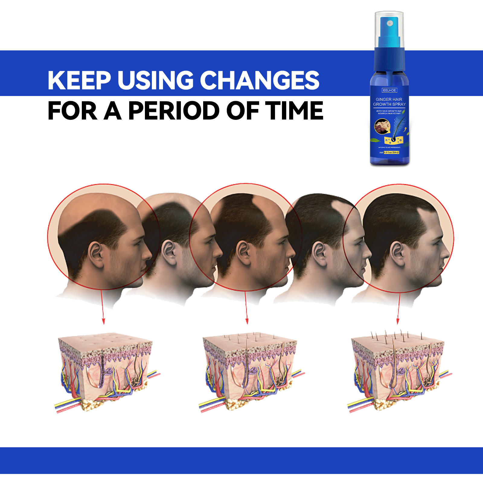 EELHOE Ginger Hair Thickening Spray, Scalp Massage Moisturizing Hair Care Nutrition Spray