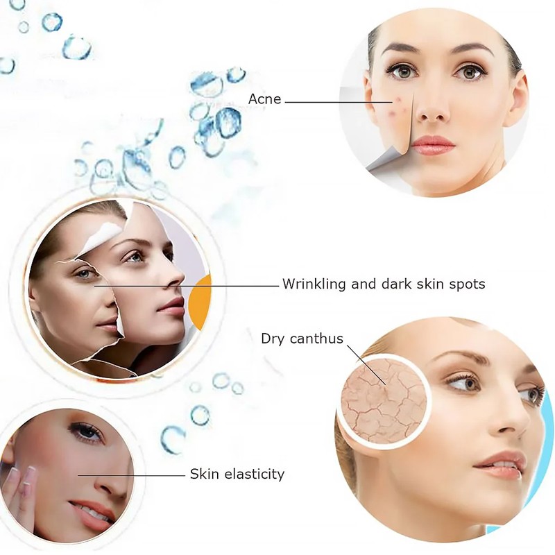 Facial Steamer Digital Face Spa Pores Steam Clean Skin Beauty Mist Sauna — image 5