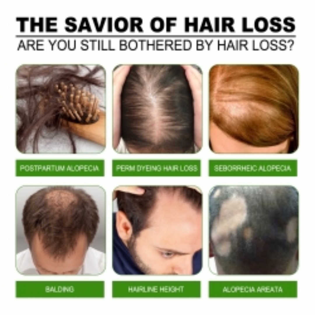 Jaysuing Hair Conditioner, Strengthens Hair, Nourishes Root Growth And Thickens Scalp Massage Nutrient Solution