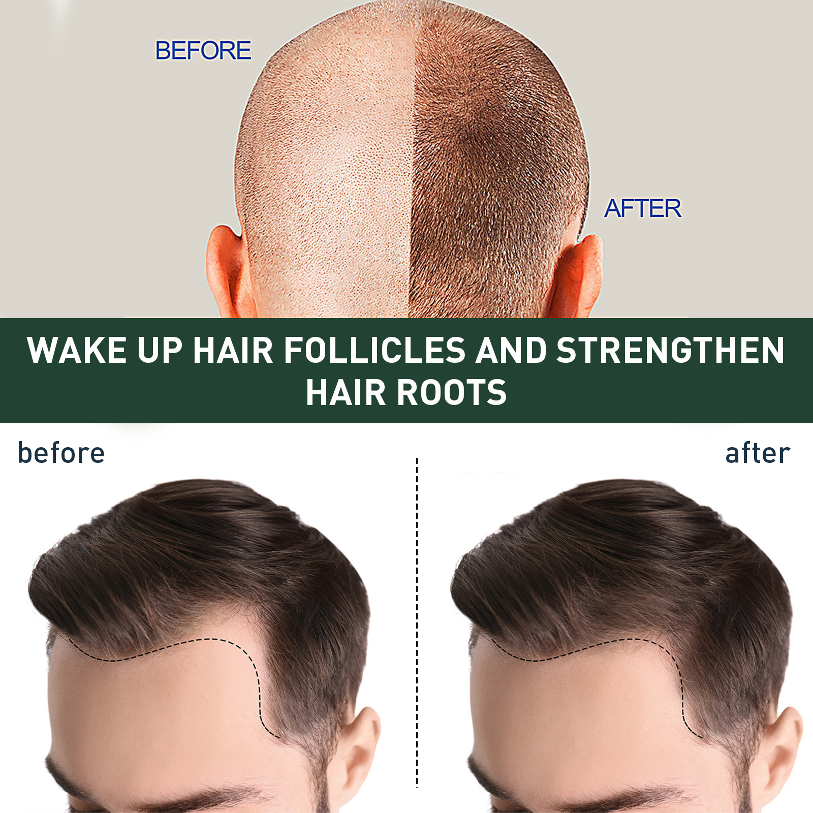 New Hairline Anti-drop - Image 10
