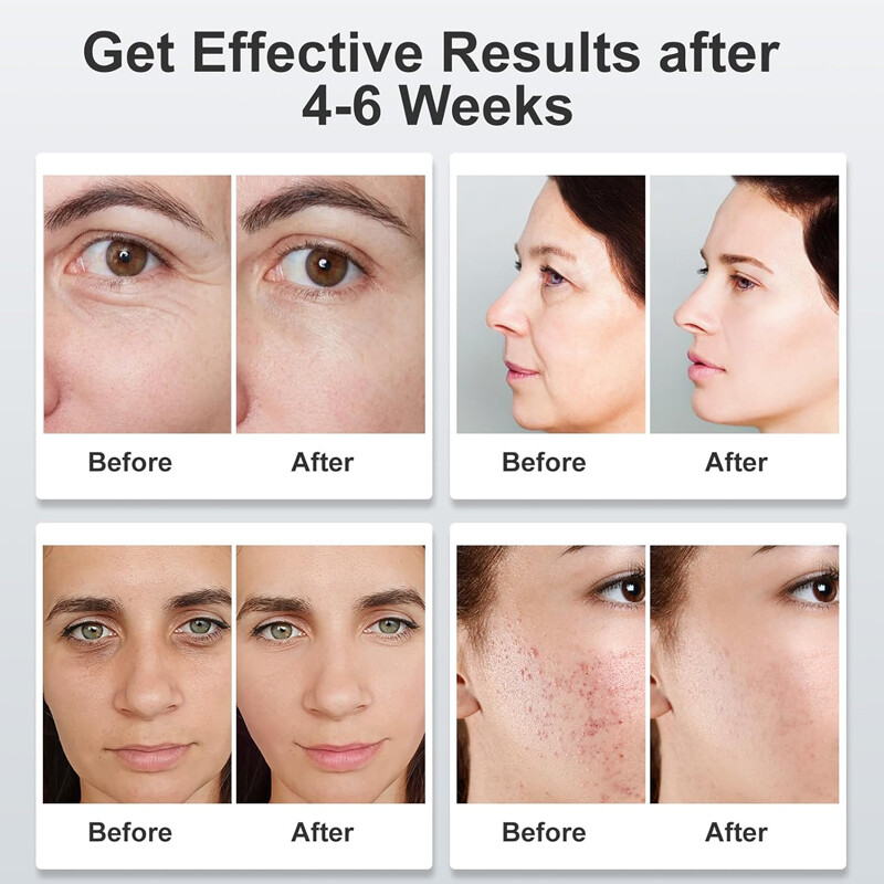 7Colors LED Light Photon Face Mask Neck Rejuvenation Skin Facial Wrinkle Therapy — image 4