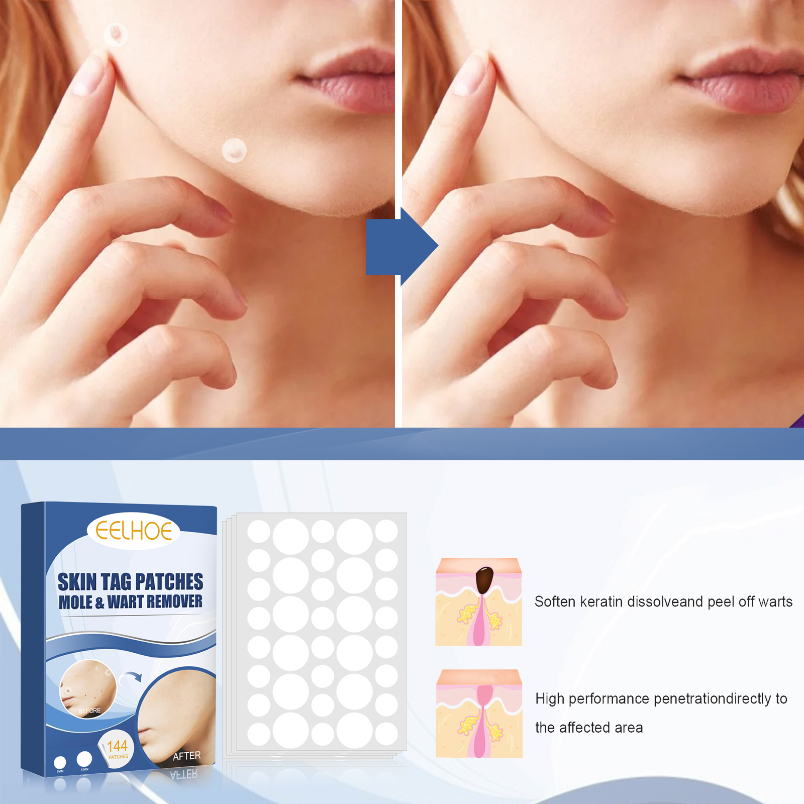 Skin Smoothing Patches   144PCS — foto 7