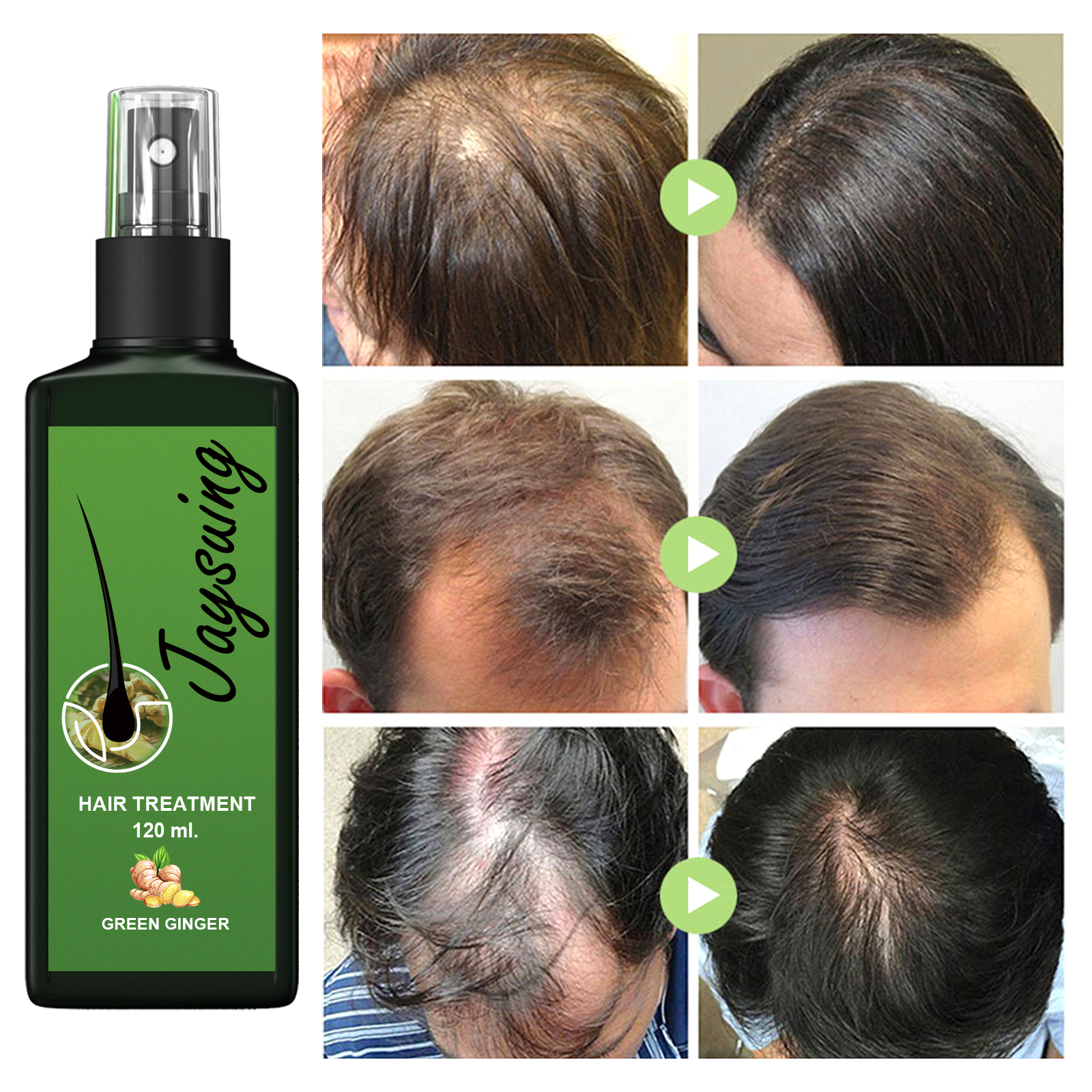 Jaysuing Hair Treatment, Strengthens Hair, Nourishes Root Growth And Thickens Scalp Massage Nutrient Solution