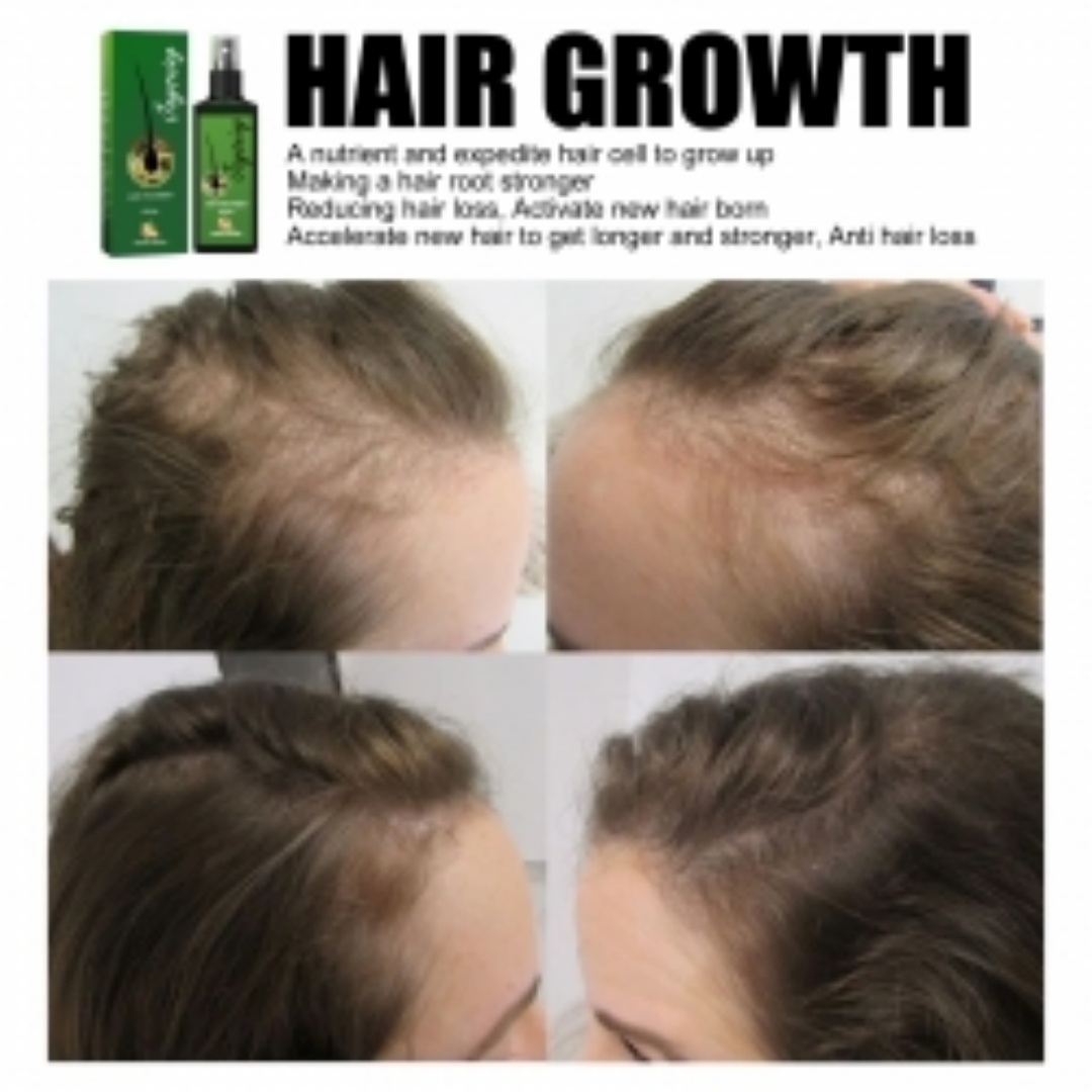 Jaysuing Hair Conditioner, Strengthens Hair, Nourishes Root Growth And Thickens Scalp Massage Nutrient Solution