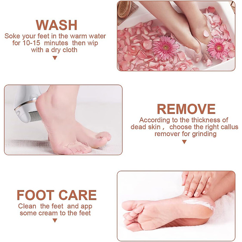Electric Foot File Rechargeable Callus Hard Skin Remover Feet Pedicure 2 Speeds — image 4