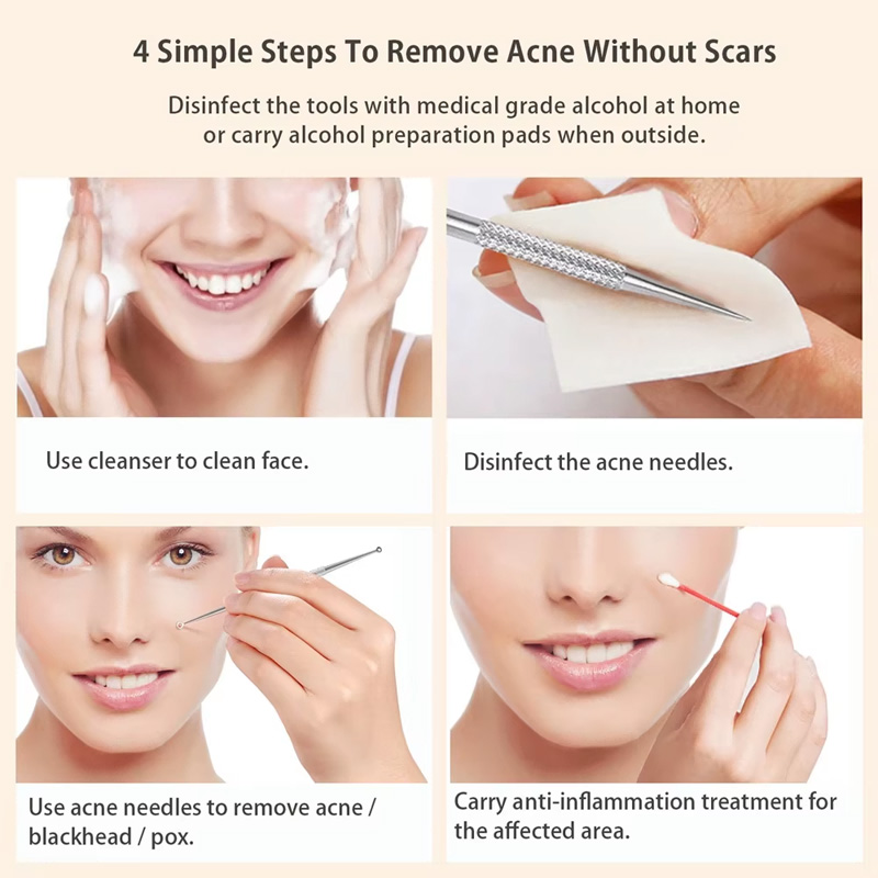 5 Acne Needles,Facial Acne Removal Extractor Blackhead Removal Kit,Blackhead Acne Remover Tool thumbnail 4