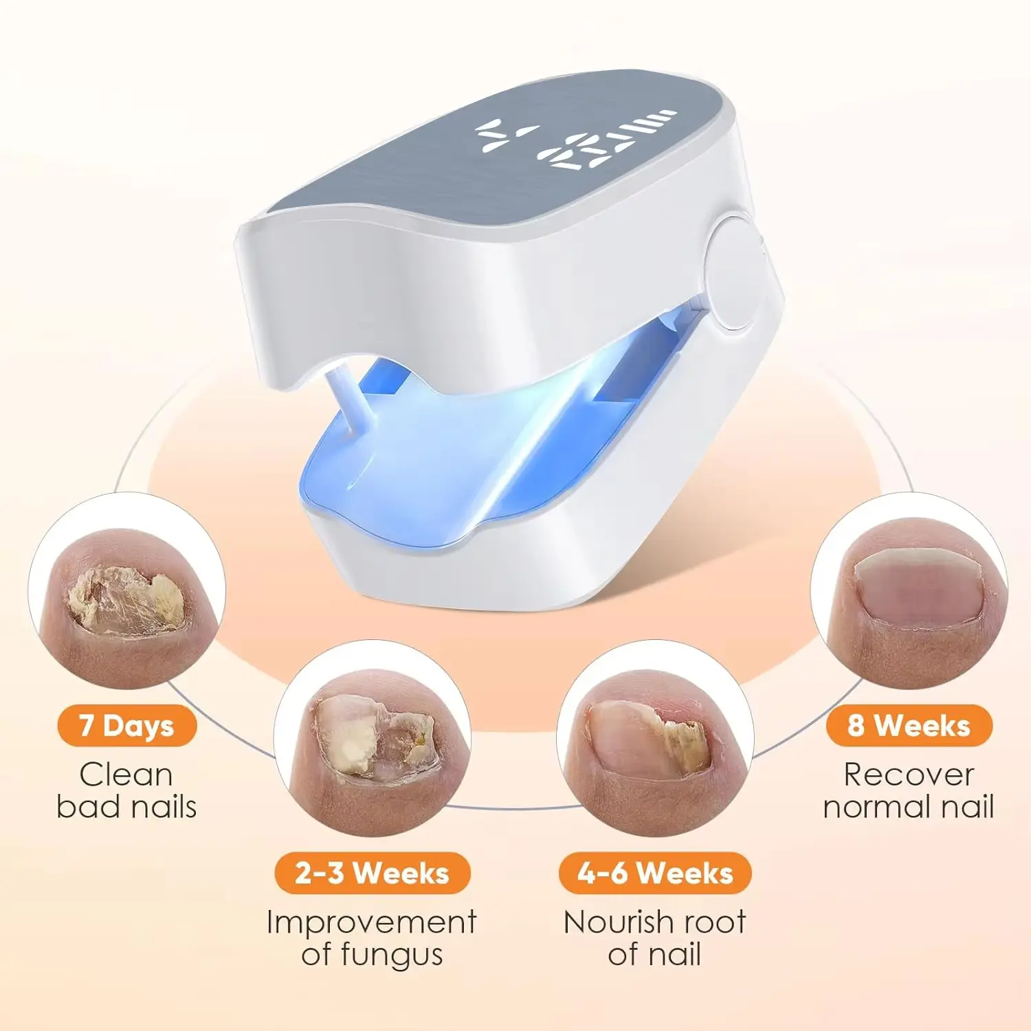 Nail Fungus Laser Treatment LED Light Device Effective Rechargeable Nail Fungus Remover Nail Fungus Cleaning Laser Device Repair Damaged Discolored Thick Finger