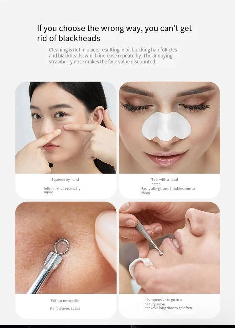 Electric Blackhead Remover Cleaner Face Diamond Pore Vacuum Suction White Heads | Elevated Statement